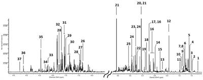 NMR-based metabolomics for investigating urinary profiles of metal carpentry workers exposed to welding fumes and volatile organic compounds
